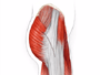 Muscle and other tissues are closed over the joint using dissolvable stitches. A temporary draining tube may be added.