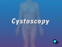 Cystoscopy only rarely leads to complications.