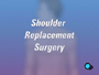 When it comes to shoulder replacement surgery, there are no real alternatives.